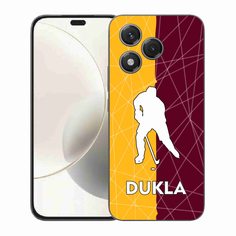 Gélový kryt mmCase na Honor 400 Lite - Dukla