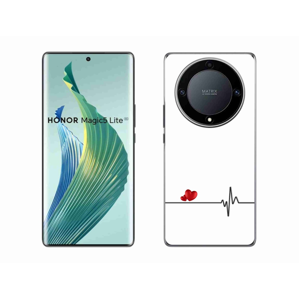 Gélový kryt mmCase na Honor Magic 5 Lite 5G - srdce a tep biele pozadie