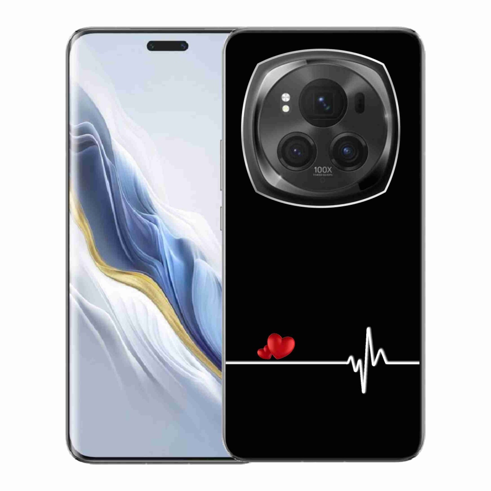 Gélový kryt mmCase na Honor Magic 6 Pro 5G - srdce a tep čierne pozadie