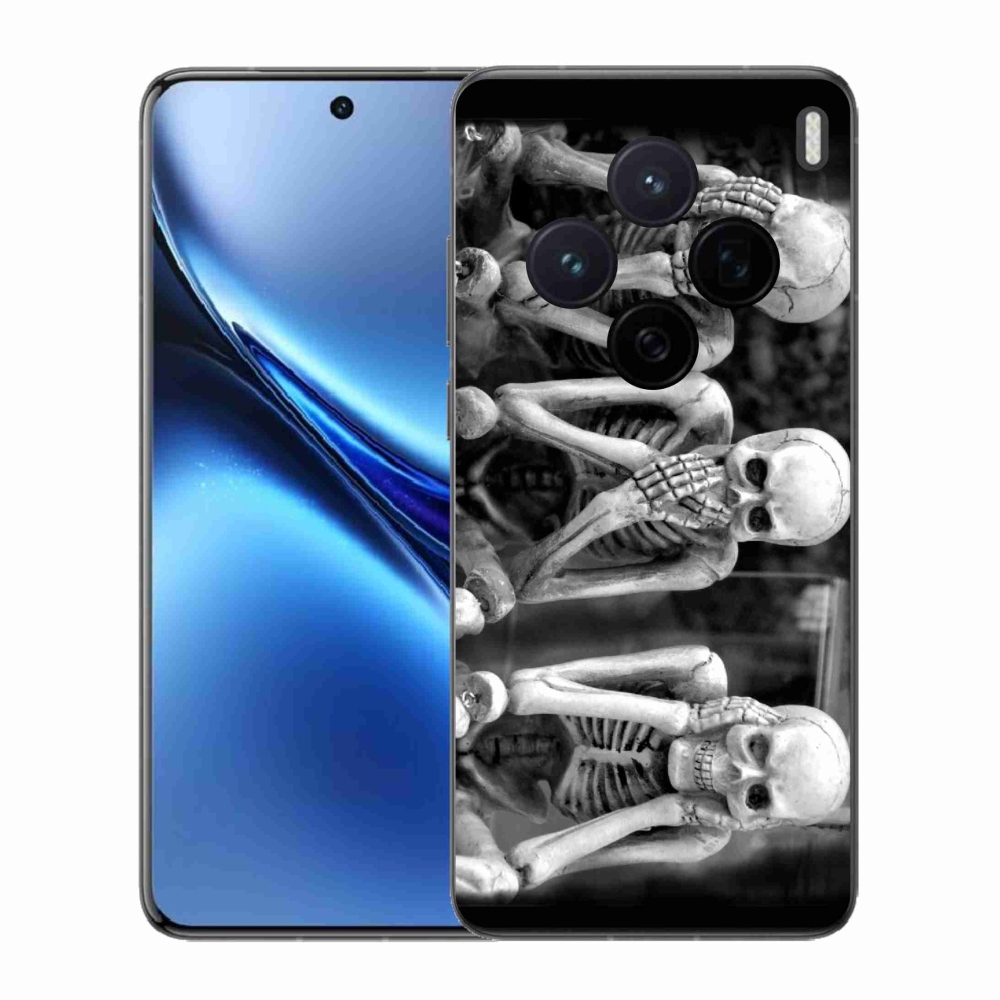 Gélový kryt mmCase na Vivo X200 5G - kostlivci