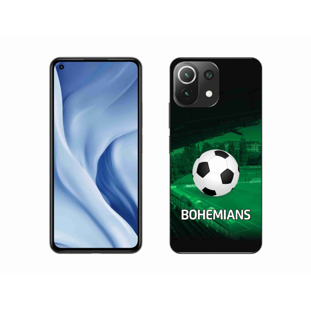 Gélový kryt mmCase na Xiaomi Mi 11 Lite 4G/5G - bohemians 1