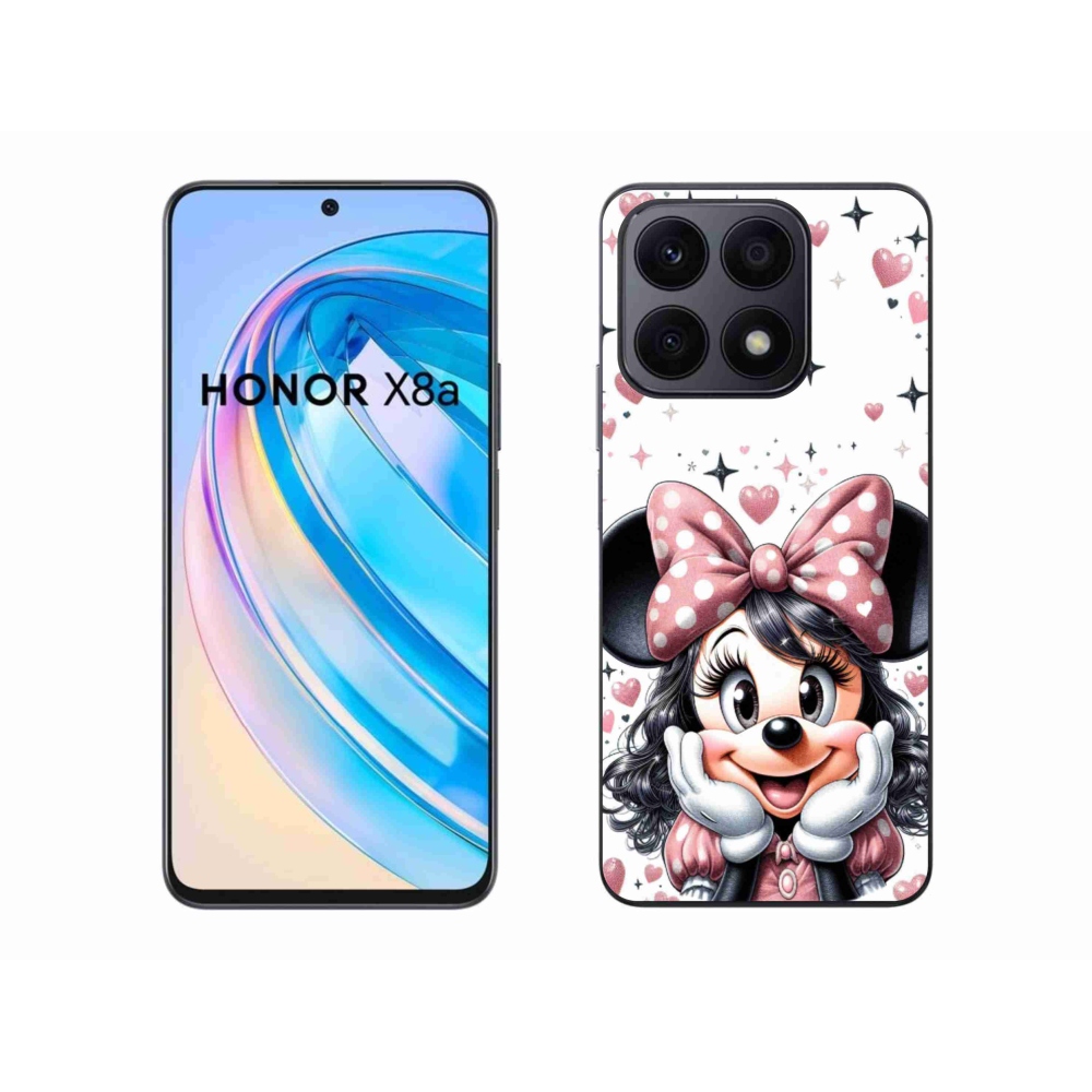 Gélový kryt mmCase na Honor X8a - minnie