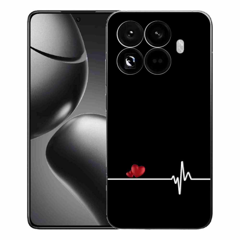 Gélový kryt mmCase na Xiaomi 15T Pro - srdce a tep čierne pozadie