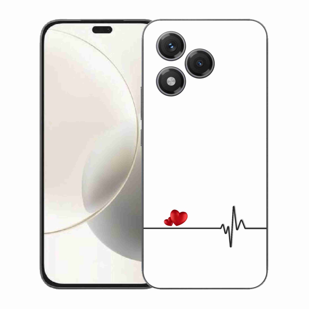Gélový kryt mmCase na Honor 400 Lite - srdce a tep biele pozadie