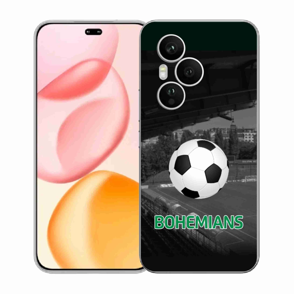 Gélový kryt mmCase na Honor 400 Pro - bohemians 2