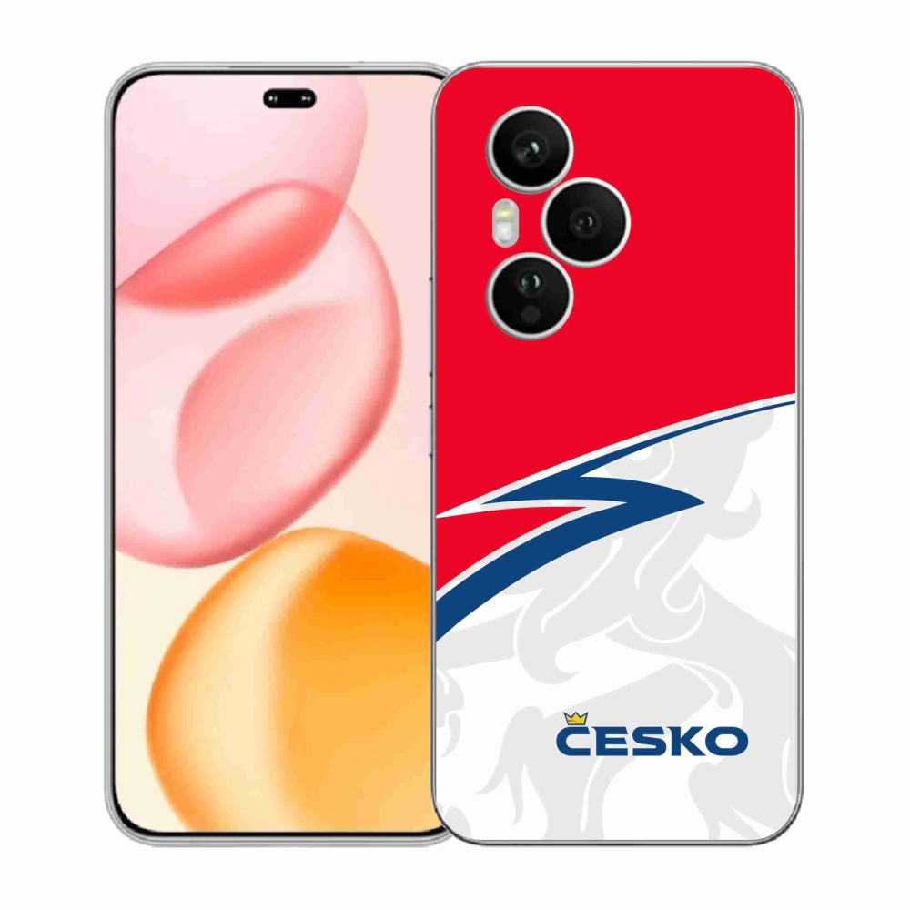 Gélový kryt mmCase na Honor 400 Pro - Česko