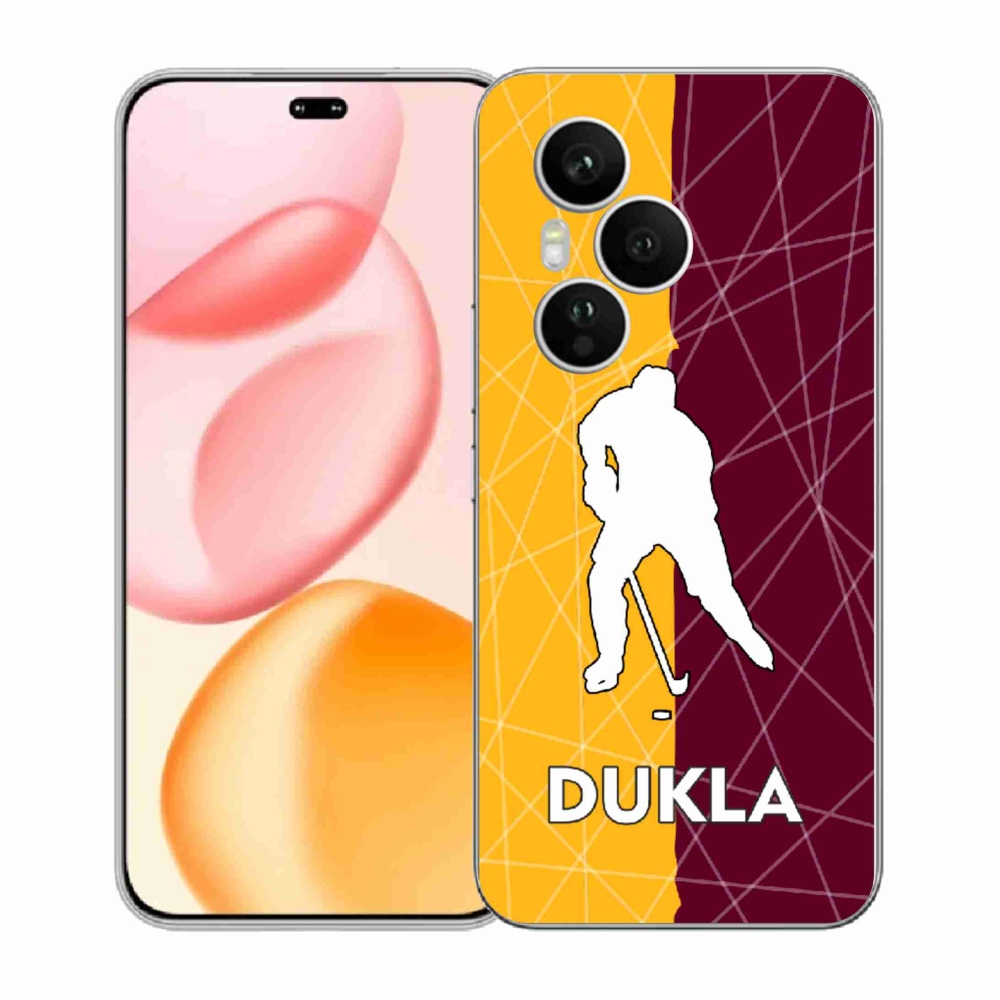 Gélový kryt mmCase na Honor 400 Pro - Dukla