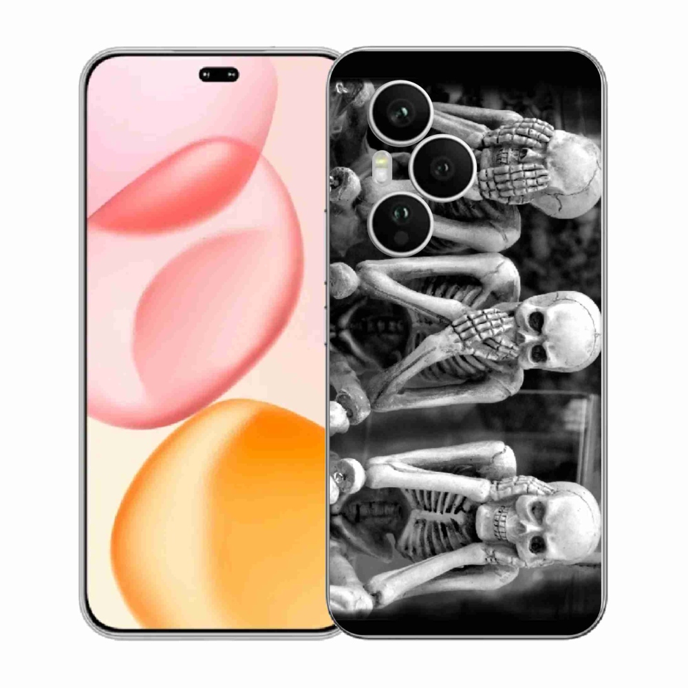 Gélový kryt mmCase na Honor 400 Pro - kostlivci