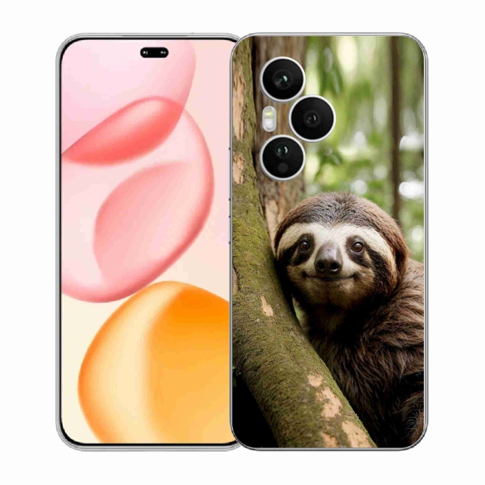 Gélový kryt mmCase na Honor 400 Pro - usmievavý leňochod