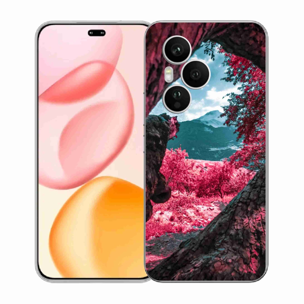 Gélový kryt mmCase na Honor 400 Pro - výhľad na hory