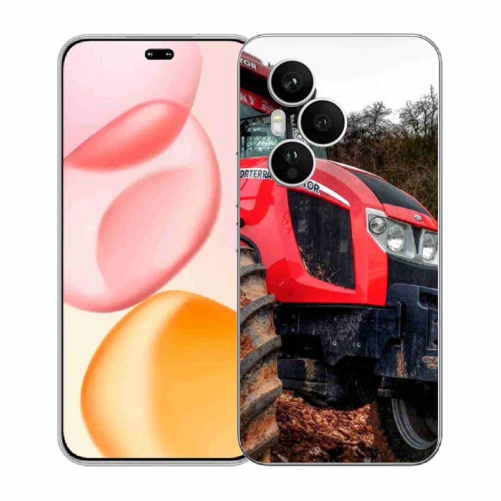 Gélový kryt mmCase na Honor 400 Pro - zetor