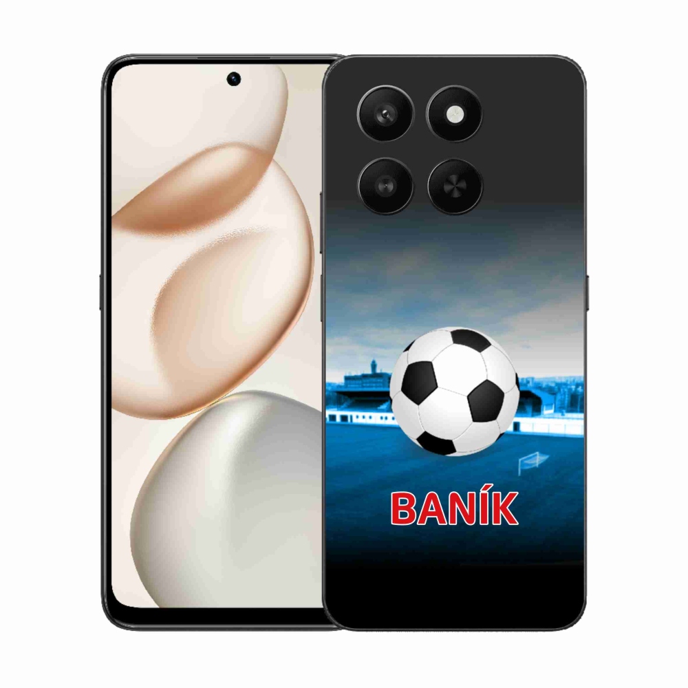 Gélový kryt mmCase na Honor 400 Smart 5G/4G/Honor X7d - baník 2