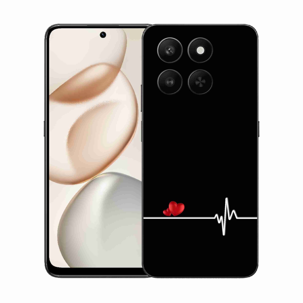 Gélový kryt mmCase na Honor 400 Smart 5G/4G/Honor X7d - srdce a tep čierne pozadie