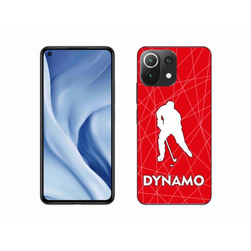 Gélový kryt mmCase na mobil Xiaomi 11 Lite 5G NE - Dynamo 2