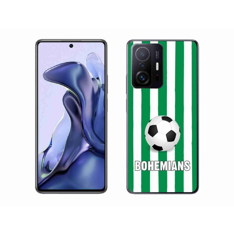 Gélový kryt mmCase na mobil Xiaomi 11T Pro - Bohemians