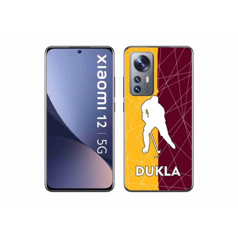 Gélový kryt mmCase na mobil Xiaomi 12 - Dukla