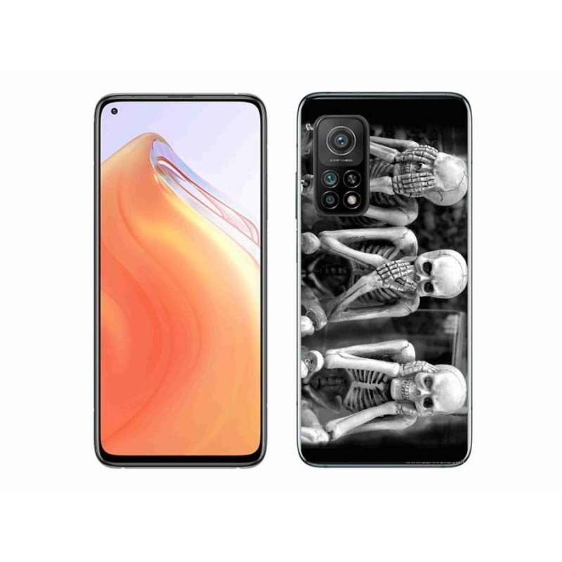 Gélový kryt mmCase na mobil Xiaomi Mi 10T 5G - kostlivci