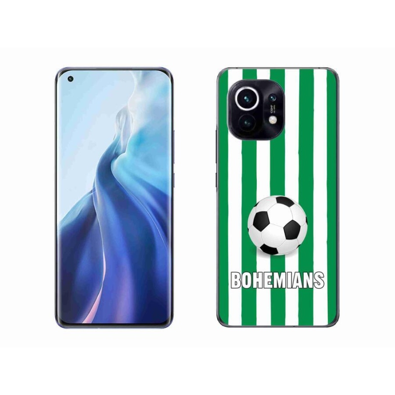 Gélový kryt mmCase na mobil Xiaomi Mi 11 - Bohemians