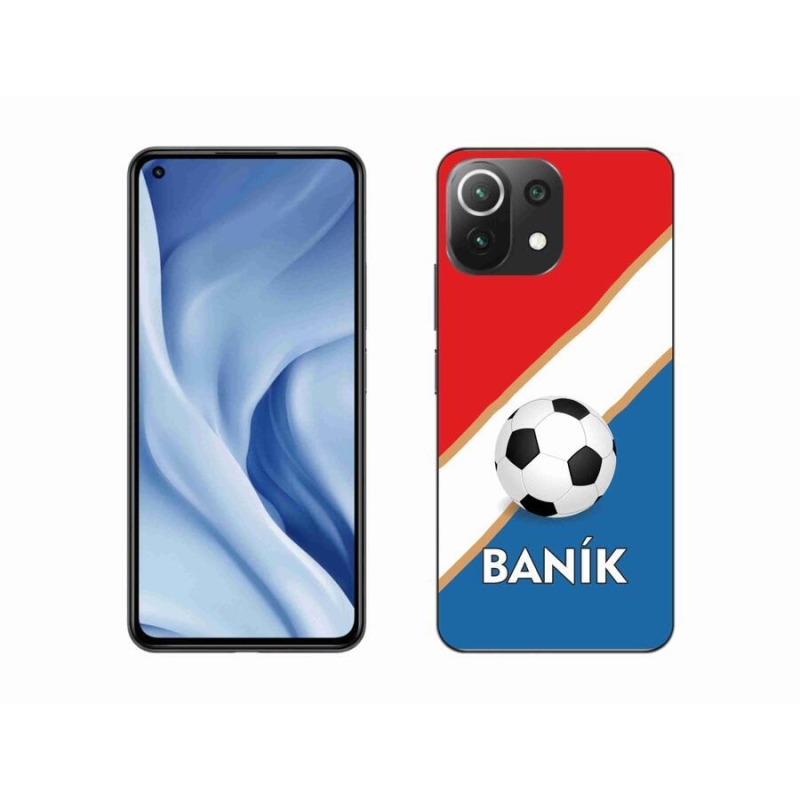 Gélový kryt mmCase na mobil Xiaomi Mi 11 Lite 4G / 5G - Baník