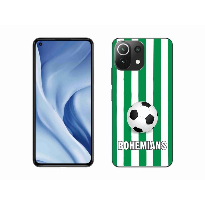 Gélový kryt mmCase na mobil Xiaomi Mi 11 Lite 4G / 5G - Bohemians