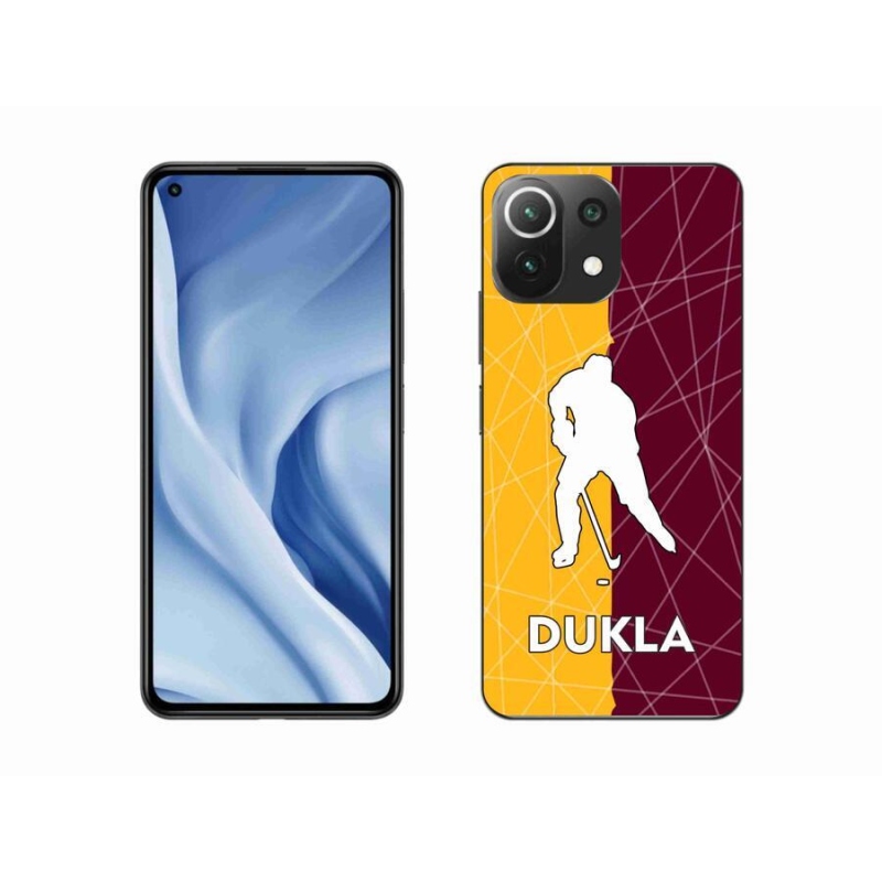 Gélový kryt mmCase na mobil Xiaomi Mi 11 Lite 4G / 5G - Dukla