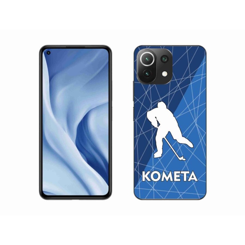 Gélový kryt mmCase na mobil Xiaomi Mi 11 Lite 4G / 5G - Kometa