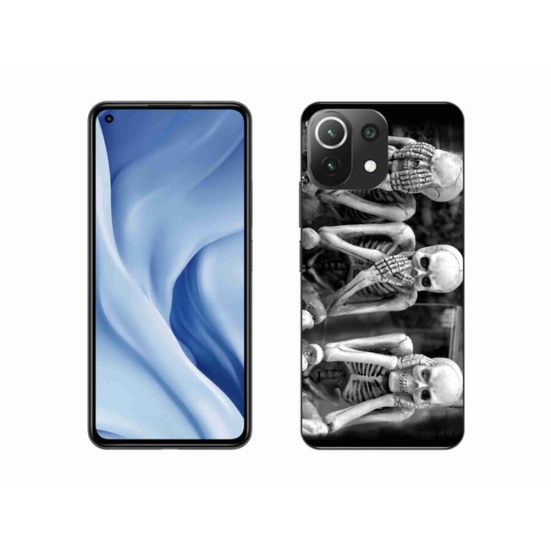 Gélový kryt mmCase na mobil Xiaomi Mi 11 Lite 4G/5G - kostlivci