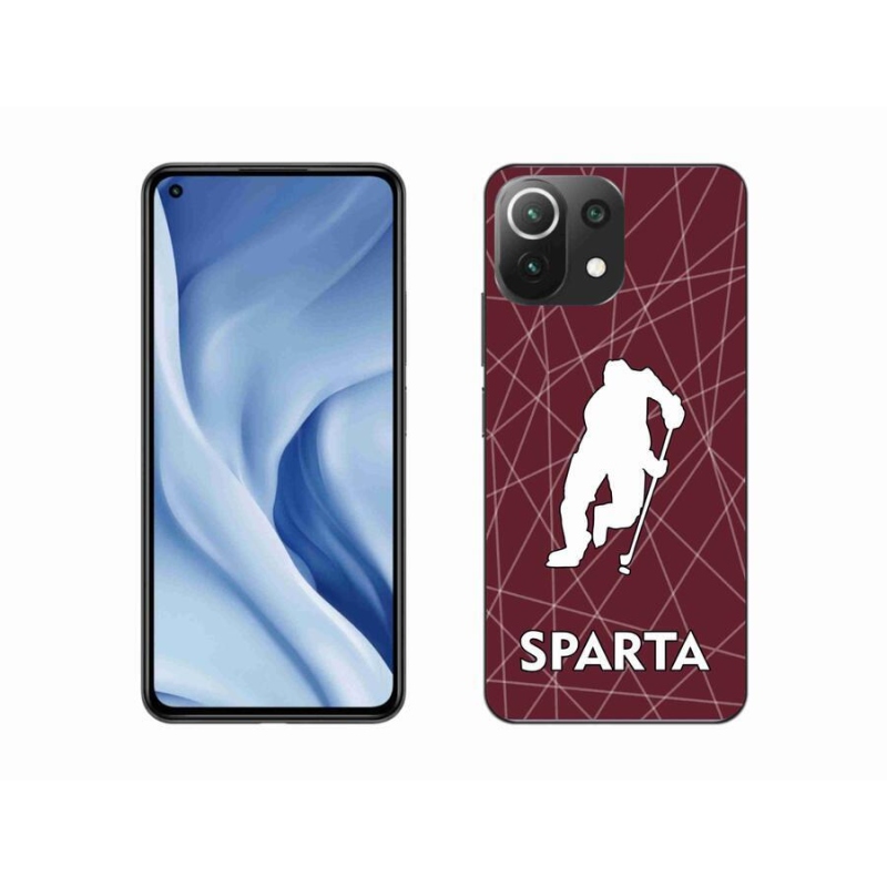 Gélový kryt mmCase na mobil Xiaomi Mi 11 Lite 4G / 5G - Sparta