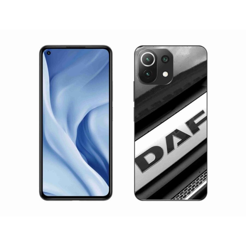 Gélový kryt mmCase na mobil Xiaomi Mi 11 Lite 4G / 5G - znak 4