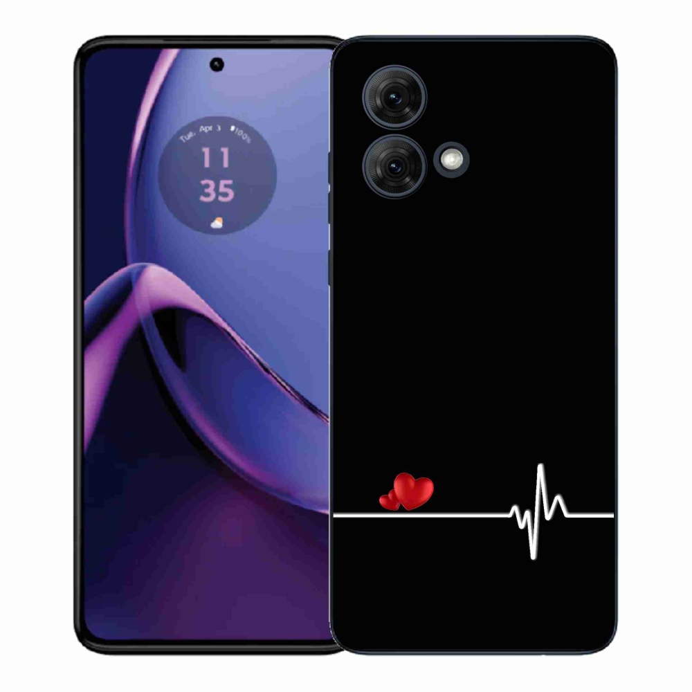 Gélový kryt mmCase na Motorola Moto G84 5G - srdce a tep čierne pozadie