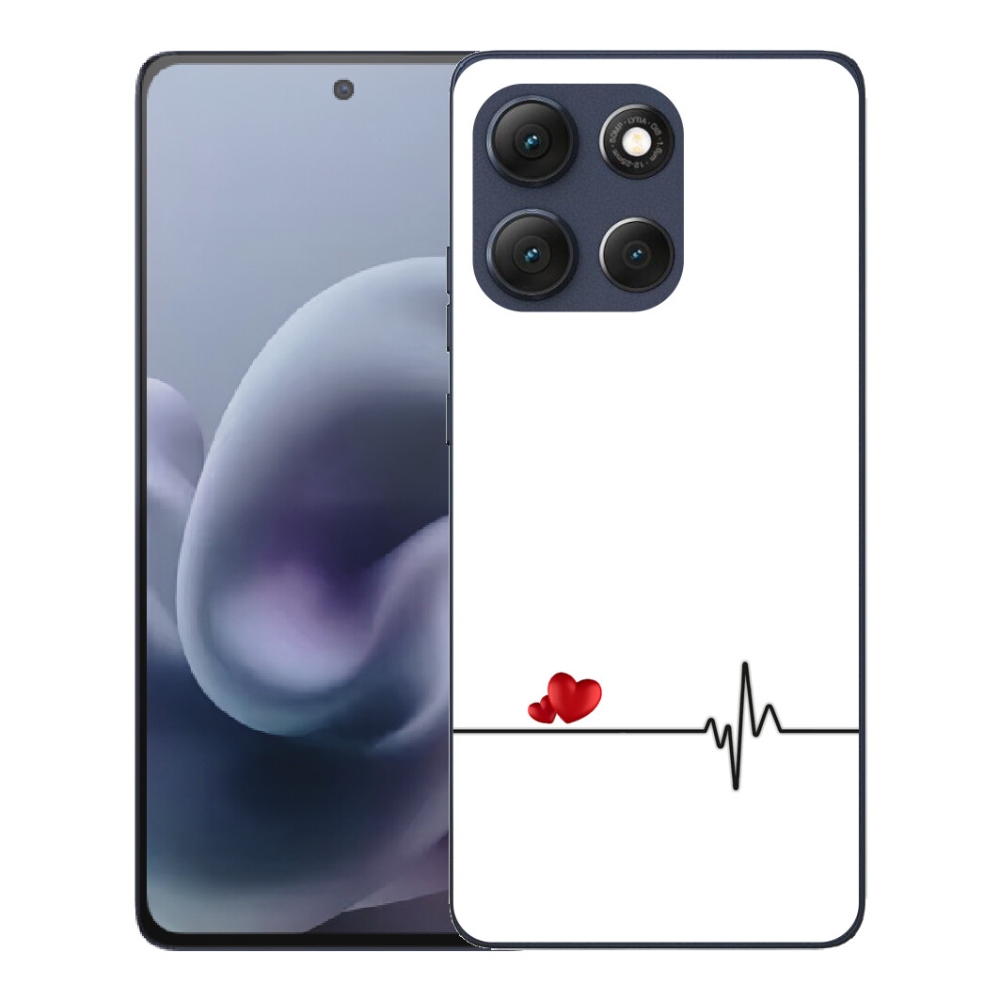 Gélový obal mmCase pre Motorola Moto G86 5G – srdce a pulz na bielom pozadí