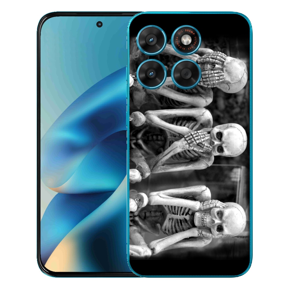 Gélový obal mmCase pre Motorola Moto G87/G77/G67 – kostlivci