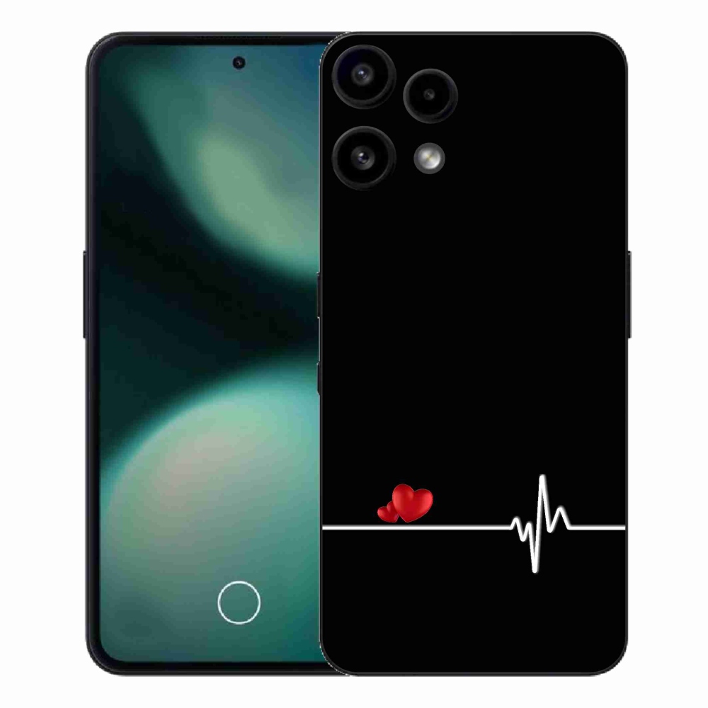 Gélový kryt mmCase na Nothing Phone (3a) Lite - srdce a tep čierne pozadie