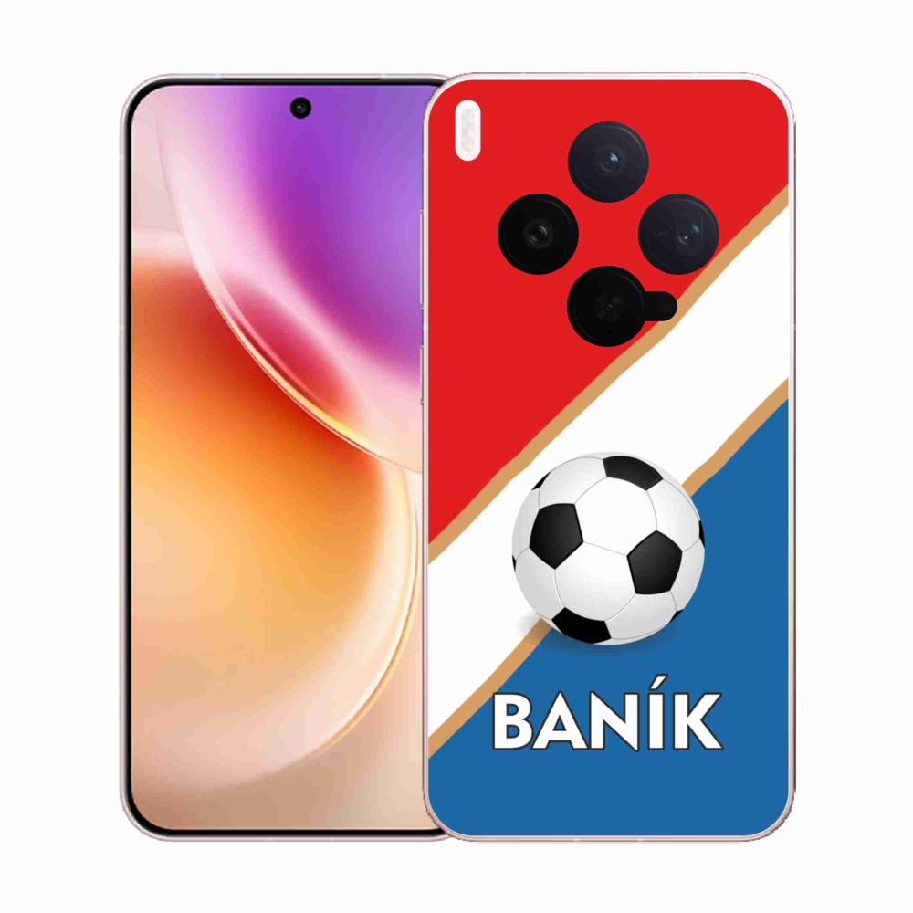 Gélový kryt mmCase na Vivo X300 - Baník