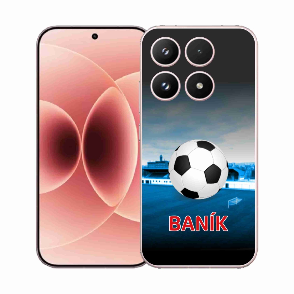 Gélový kryt mmCase na Xiaomi 17 - baník 2