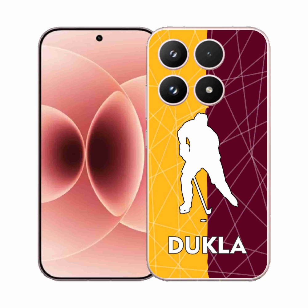 Gélový kryt mmCase na Xiaomi 17 - Dukla