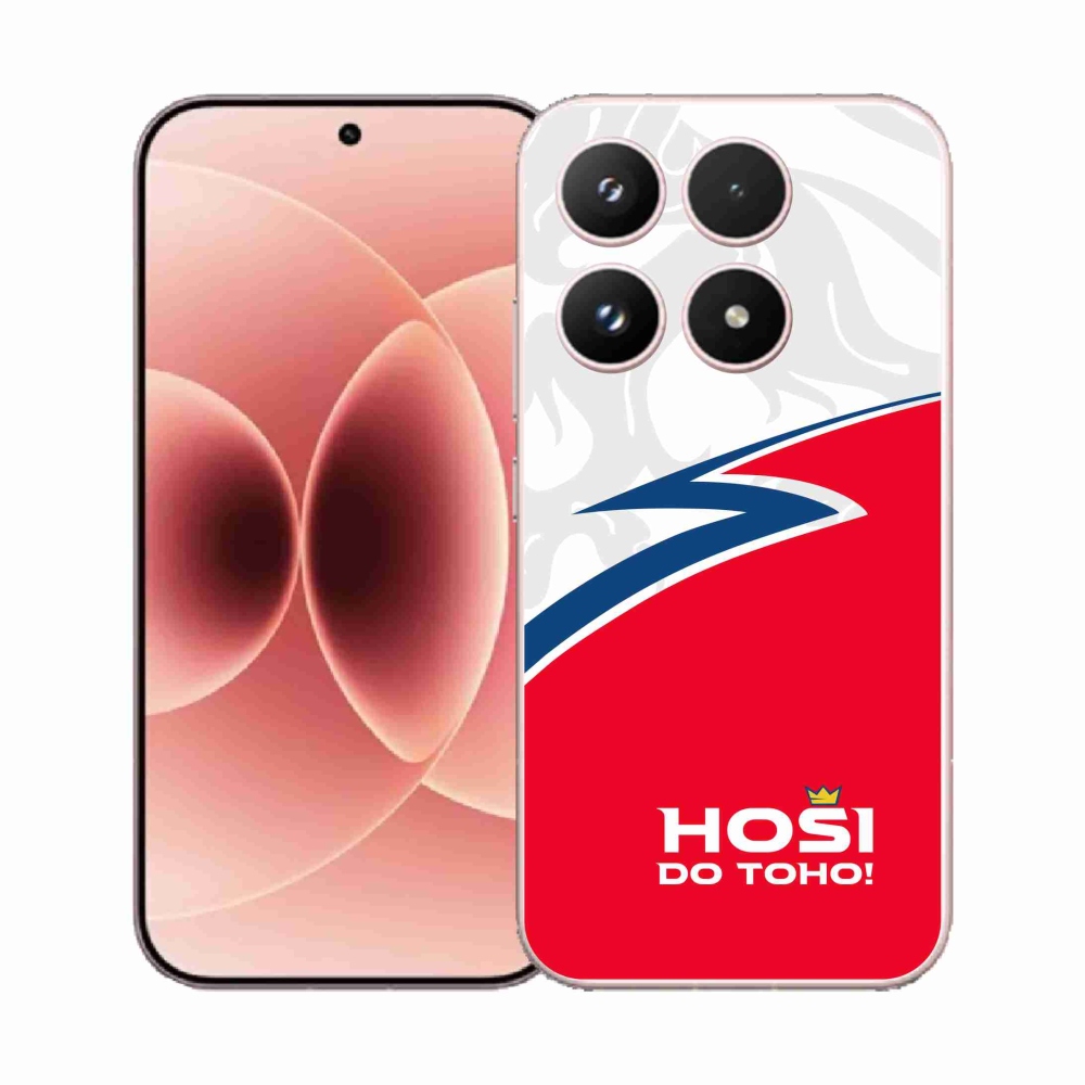 Gélový kryt mmCase na Xiaomi 17 - chlapci do toho 1