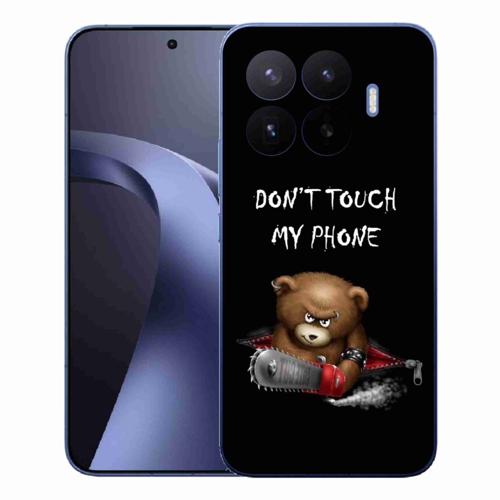 Gélový kryt mmCase na Xiaomi 17T Pro - nesiahaj na telefón