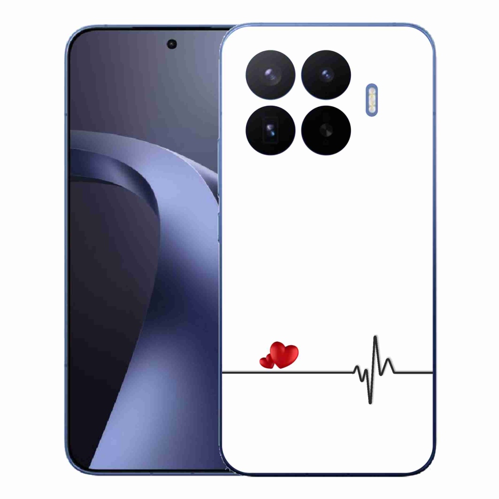 Gélový kryt mmCase na Xiaomi 17T Pro - srdce a tep biele pozadie