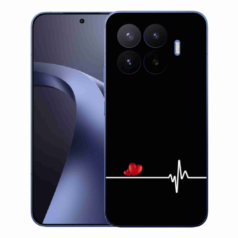 Gélový kryt mmCase na Xiaomi 17T Pro - srdce a tep čierne pozadie