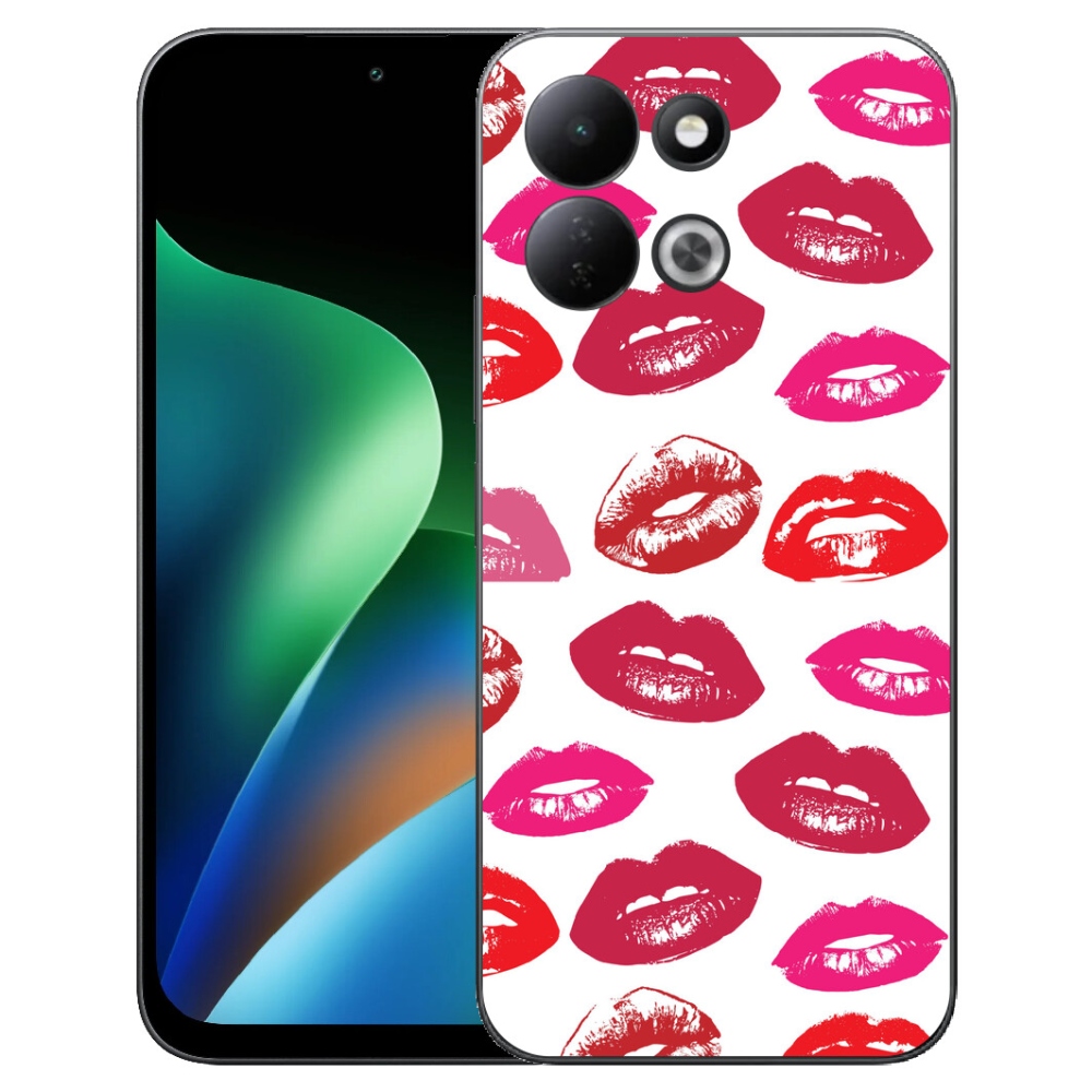 Gélový kryt mmCase na Xiaomi Redmi 17 4G/5G - pery