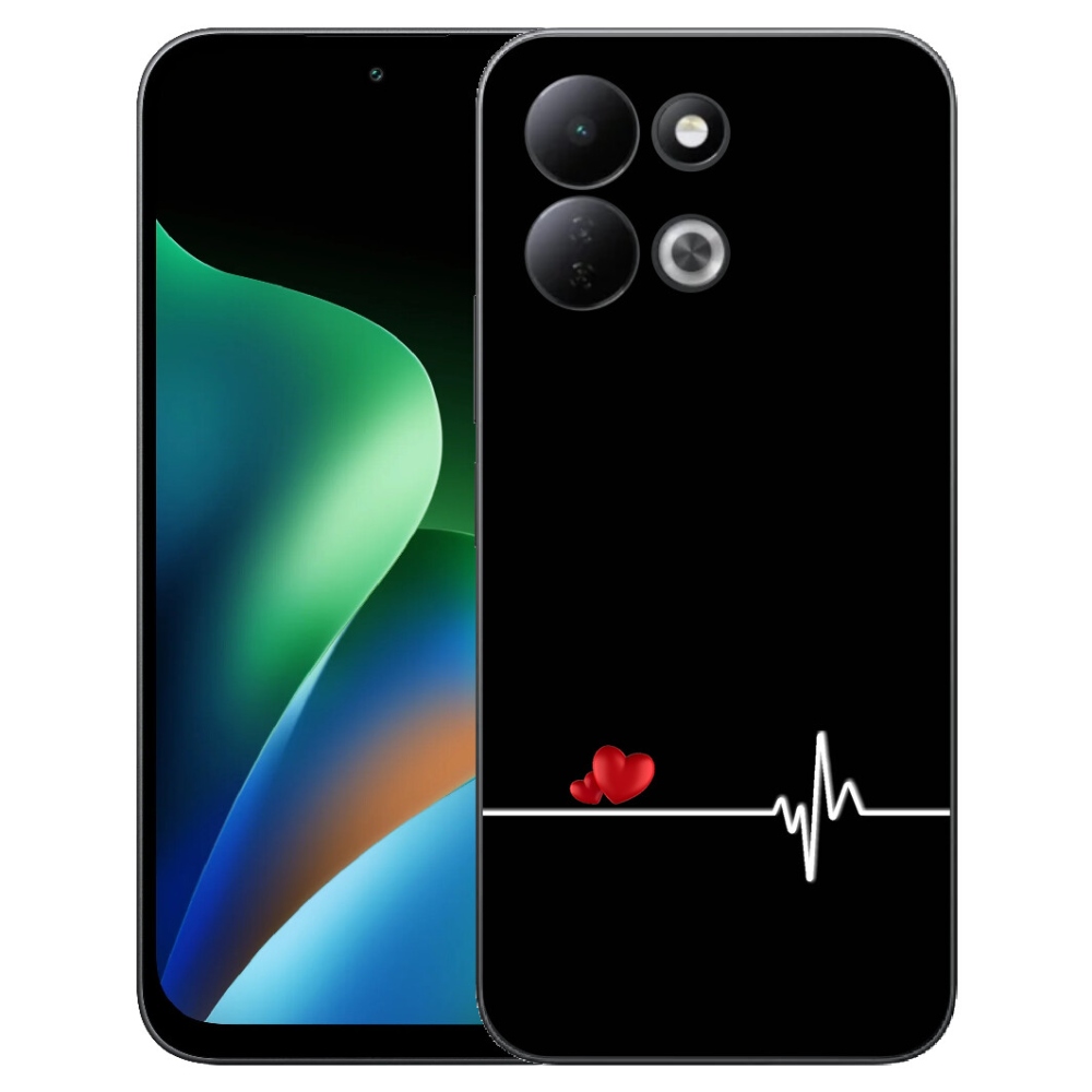 Gélový kryt mmCase na Xiaomi Redmi 17 4G/5G - srdce a tep čierne pozadie