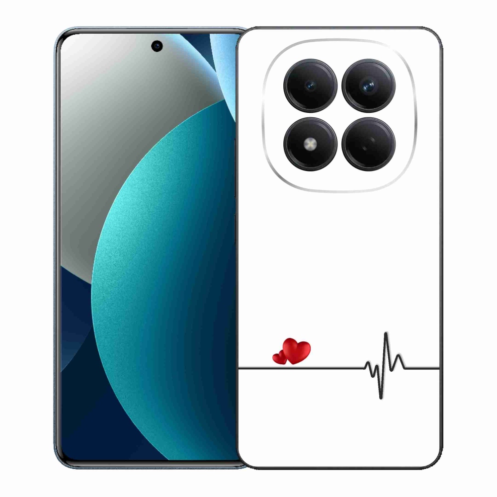 Gélový kryt mmCase na Xiaomi Redmi Note 15 Pro - srdce a tep biele pozadie
