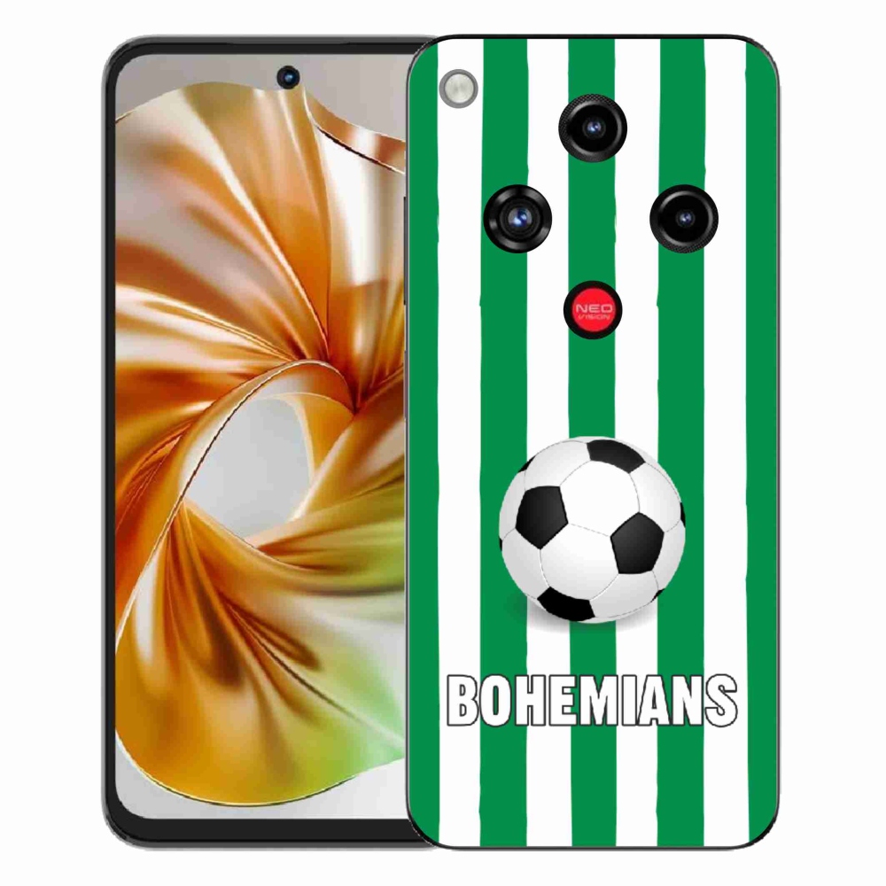 Gélový kryt mmCase na ZTE Nubia Focus 2 - Bohemians